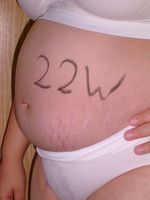 22. Woche